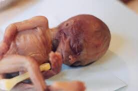 She has blood on her hands

Good evening Bahama Drama please keep me anonymous. 

My sister is 37 years old and by now I feel like she should know better and should have changed.

