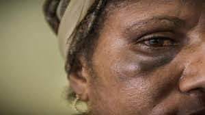 My son hit me
Good morning Bahama Drama please keep me anonymous.
I never thought that I would see the day when my own child would strike me down.
My son and I was discussing wh