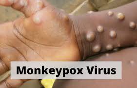 The World Health Network has just declared Monkeypox outbreak, as a global pandemic.
Get prepared Bahamas. More Vaccines are coming.
LAST DAYS...