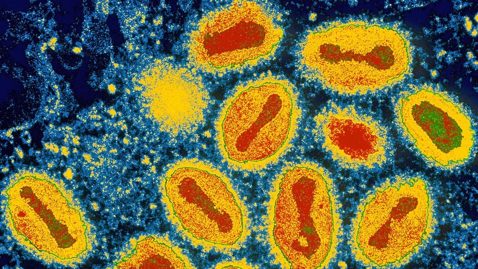 Deadly virus outbreak
Da'rumors is an old deadly virus that has resurface throughout the Bahamas the ministry of health are aware of.
This virus is very dangerous and very contag
