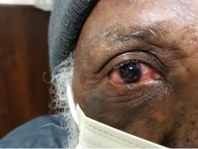Breaking Hush hush news!

Politician Charged with Crazy Glue Eyelid Prank

Nassau, The Bahamas (June 25, 2023) - A sitting politician was charged today with gluing his father's eye