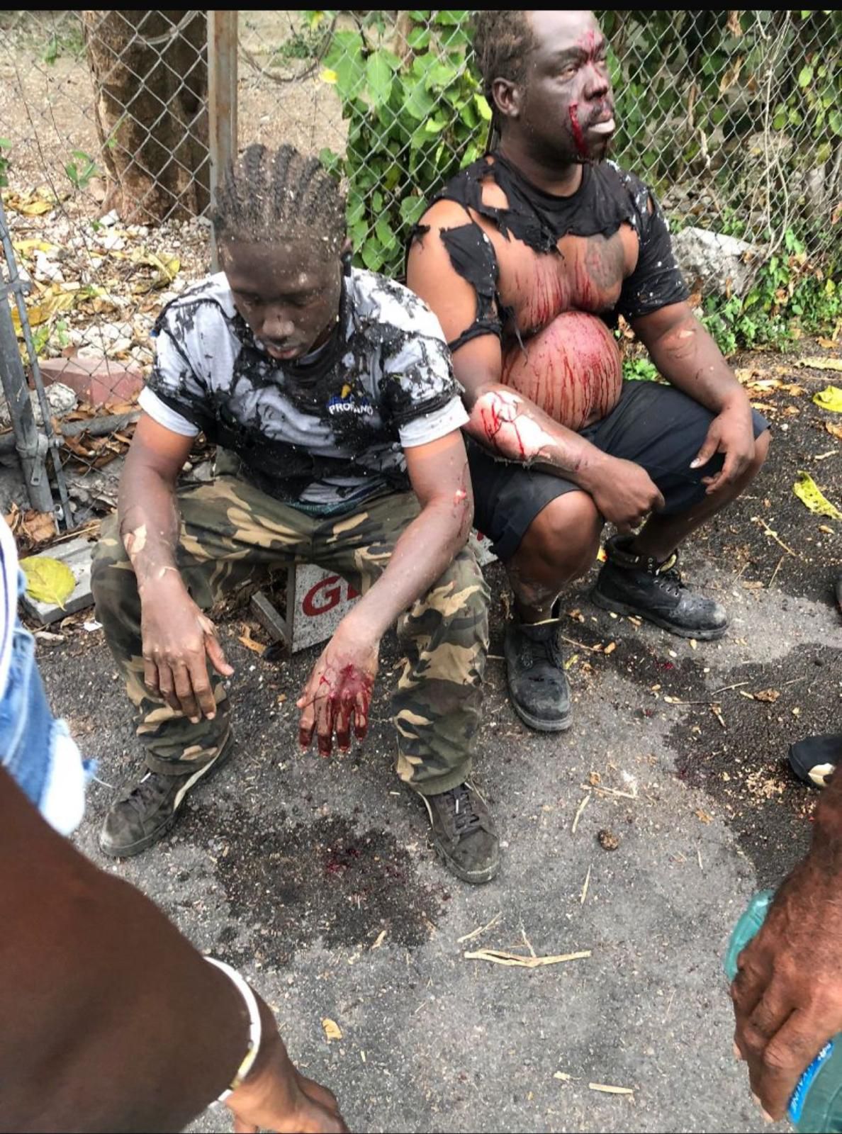 VICTIMS OF HOUSE EXPLOSION SURVIVE MIRACULOUSLY

A Bahama Drama journalist on the scene reports that the victims of today’s house explosion in New Providence are fortunate to be al