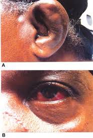 Booster shots for the 2025 Hater virus are available at PMH
Article below:
The hater virus is a very contagious pathogen and is thought to be only carried by haters, but new info