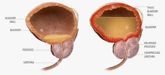 Prostate gland rebirth 

If you got prostate gland problems or cancer God gave me this treatment and who knows it could be a cure as far as @[100023394293756:2048:Bahama Drama] kno