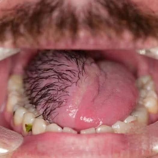 The girls dem bubble gum 

Hi I'm from Long Island. I was born with a rare genetic disorder that caused hair to grow on my tongue and because of that it makes me the best French ki
