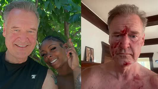 Bahama Drama News
Former Bay Area News Anchor Frank Somerville Arrested After Heated Altercation With Daughter

Oakland, California – A shocking turn of events has placed one of th