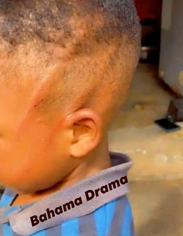 What is your next move if a teacher does this to your child? Just asking for a friend. 

Page Reply:

Ask how did it happen...