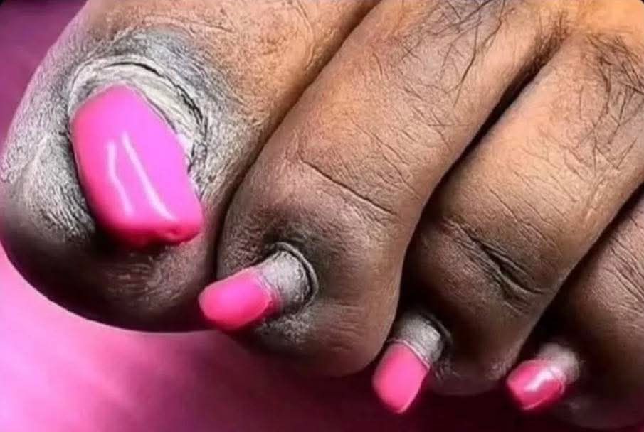 Beauty Salons nail technicians and owners around the world, what's your first move? 

She wants to be able to wear open toe shoes and she only has 30 minutes to spear as a walk-in.