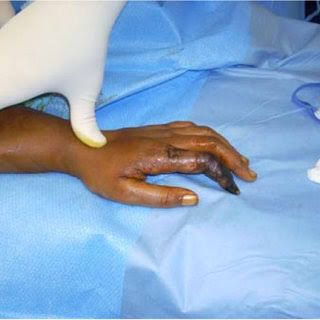 Kemp Road: her rotting finger
Good night Bahama Drama, please keep me anonymous. I need to share a true tale dat just happen to a friend of mine from Kemp Road. De old people dem